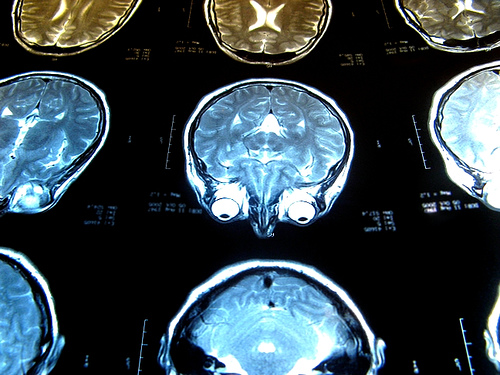 Cydcor-Sales-Life-Hacks-Right-Brain